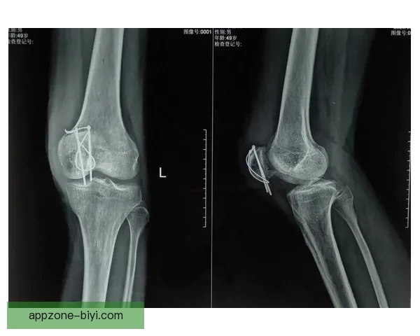 穆迪将随队回湾区接受核磁共振检查 期待早日康复